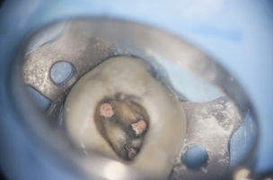 千葉県茂原市の歯医者、たけ歯科クリニックのマイクロスコープ精密治療