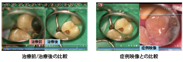 千葉県茂原市の歯医者、たけ歯科クリニックの解りやすいカウンセリング