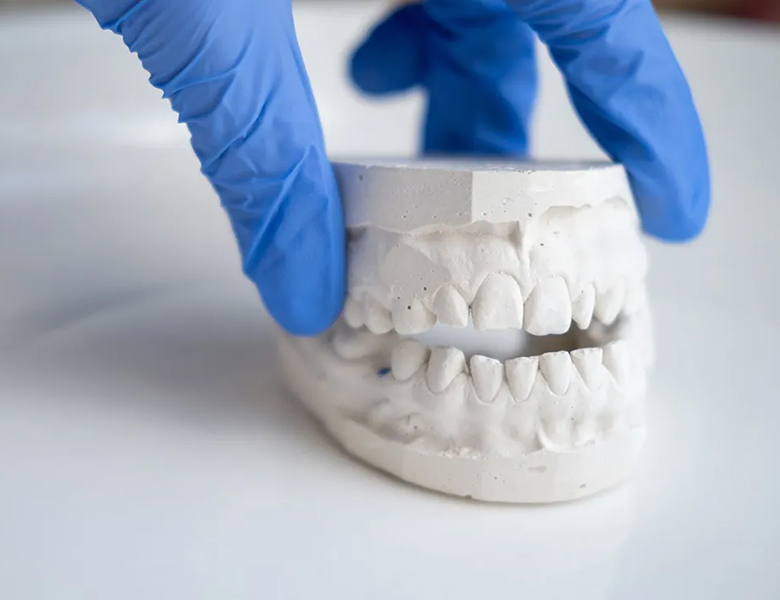 千葉県茂原市の歯医者、たけ歯科クリニックの歯ぎしり、食いしばり