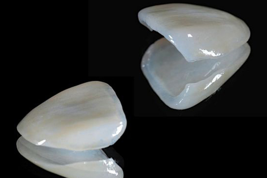 茗荷谷駅徒歩2分の歯医者｜佐藤歯科医院の審美歯科