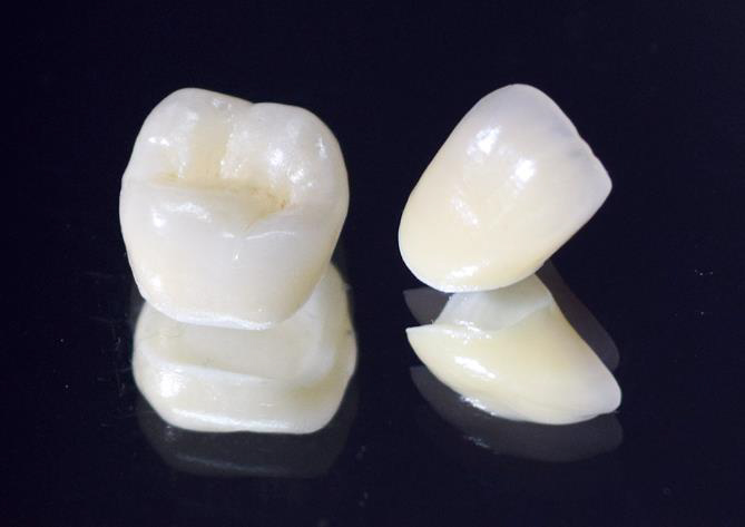 千葉県茂原市の歯医者、たけ歯科クリニックの審美歯科治療